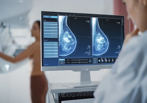 Впервые искусственный интеллект точно диагностирует рак молочной железы